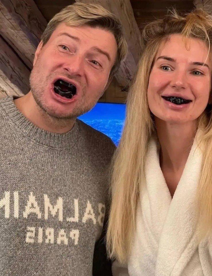 Николай Басков удивил поклонников снимком с «чёрными» зубами. 😁