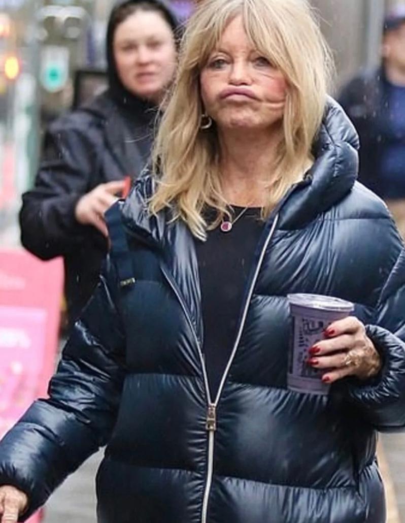 Неудачный выход или последствия пластики