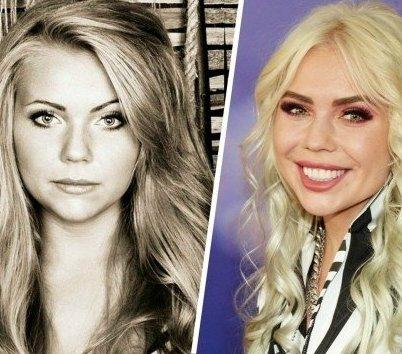 Карина Кросс открыто заявила, что её «инстаграмное» лицо с гипертрофированными губами и остро очерченным подбородком вошло в прямой конфликт с её внутренним содержанием.💔