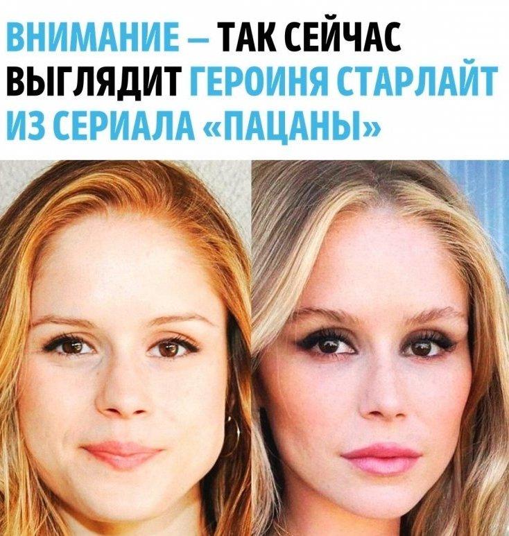 «Как будто снова увидела свет»: Эрин Мориарти откровенно рассказала о борьбе с болезнью Грейвса ✨