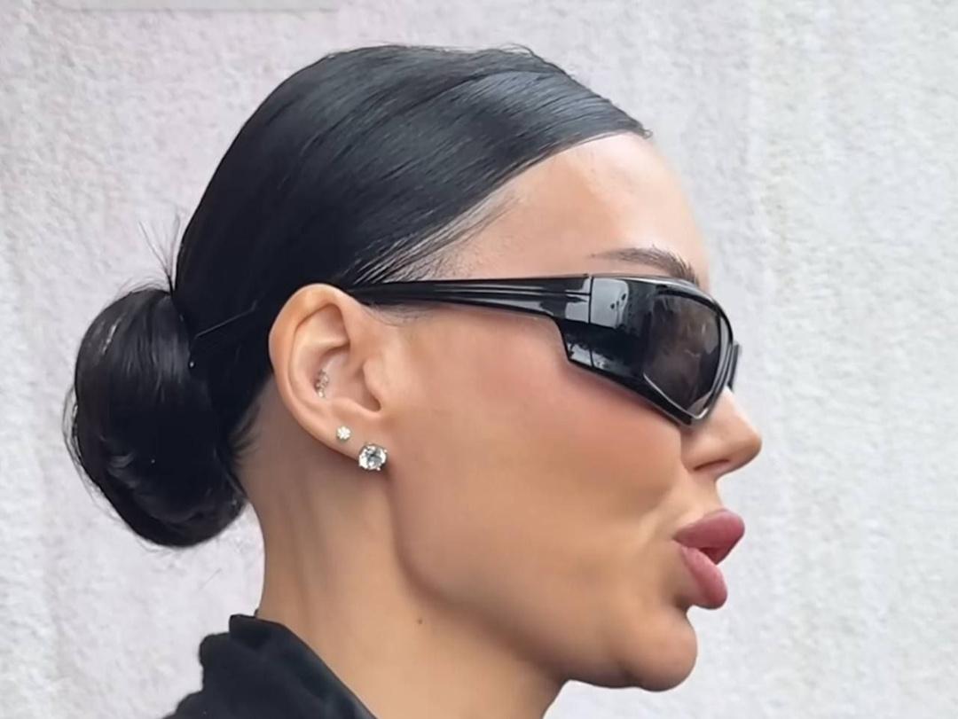 Филлер из козьего подбородка Оксаны Самойлова тянется к земле