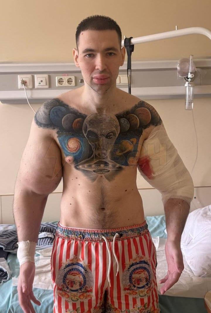 РУКИ БАЗУКИ ЖДЕТ АМПУТАЦИЯ  По данным СМИ, спасательные операции сейчас невозможны из-за плохих анализов: прежде чем продолжать вмешательства, врачам нужно стабилизировать состояние Кирилла Терёшина.