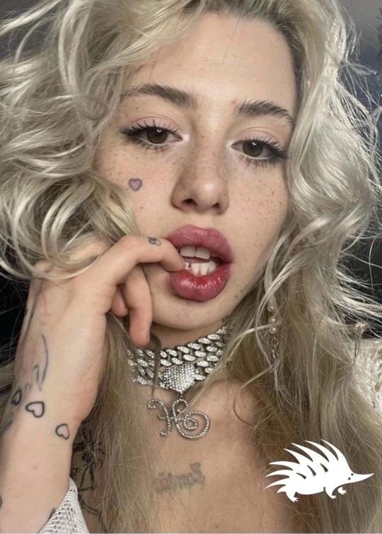 Мечта о ребенке: Хоффманита призналась, что не может забеременеть из-за алк*гольной зависимости &#128531;