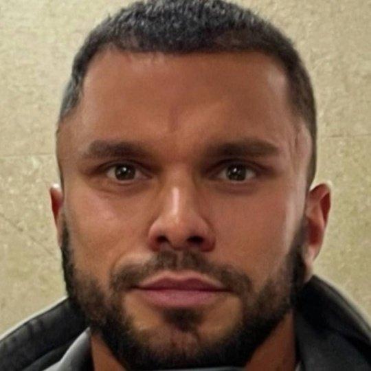 Антон Гусев с новым "открытым взглядом" после пластики