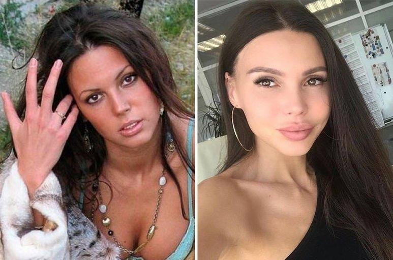 Оксана Самойлова перешла в контрнаступление против слухов о своей «переделанности», официально подтвердив лишь две пластические операции